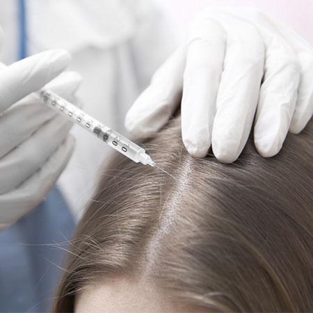 Mesotherapy of the scalp in Tashkent