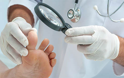 Signs and development of onychomycosis (nail fungus) in Tashkent