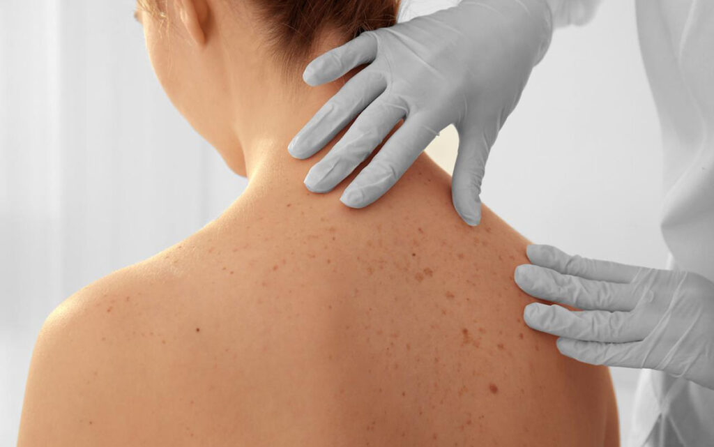 Toshkentda psoriazni davolash