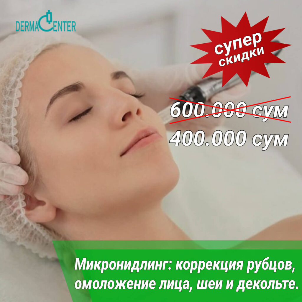 Микронидлинг - омолаживающий эффект, коррекция стрий в Ташкенте